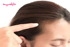 رویش مجدد مو با ژل خرید تقویت کننده موی سر و ابرو فولیوِست پرودرما از داروخانه اینترنتی دارشید